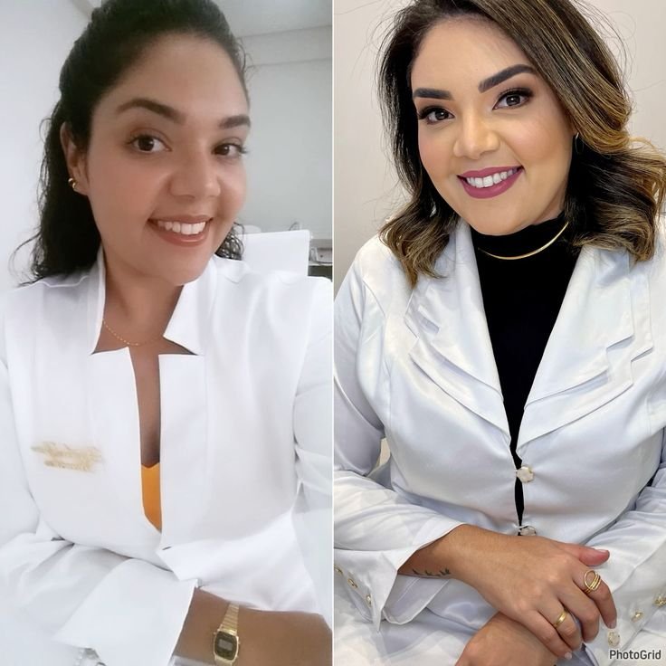 Antes y después